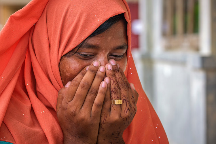 Refugiada rohingya superviviente