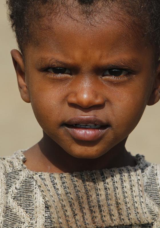 Guerra en Yemen niño Niño pequeño Yemen