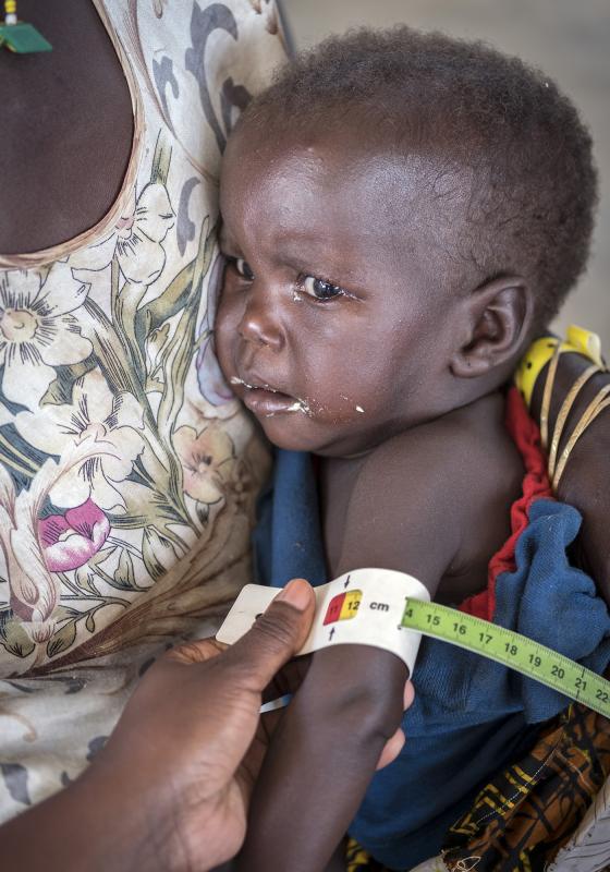 Hambre en África niño Hambre en África niño