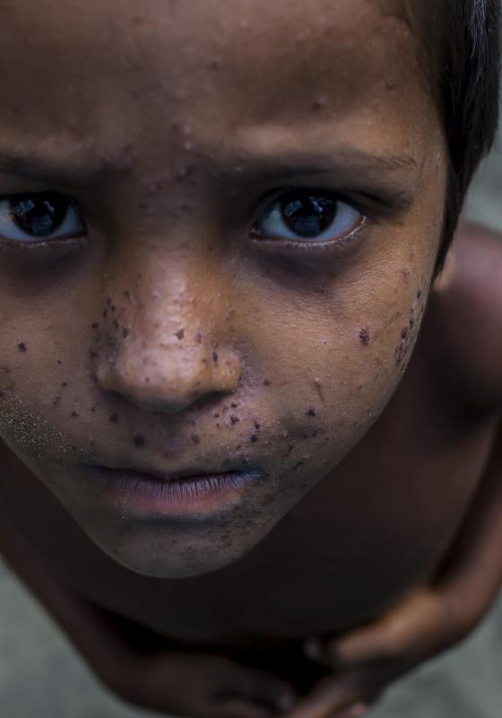 Niño rohingya