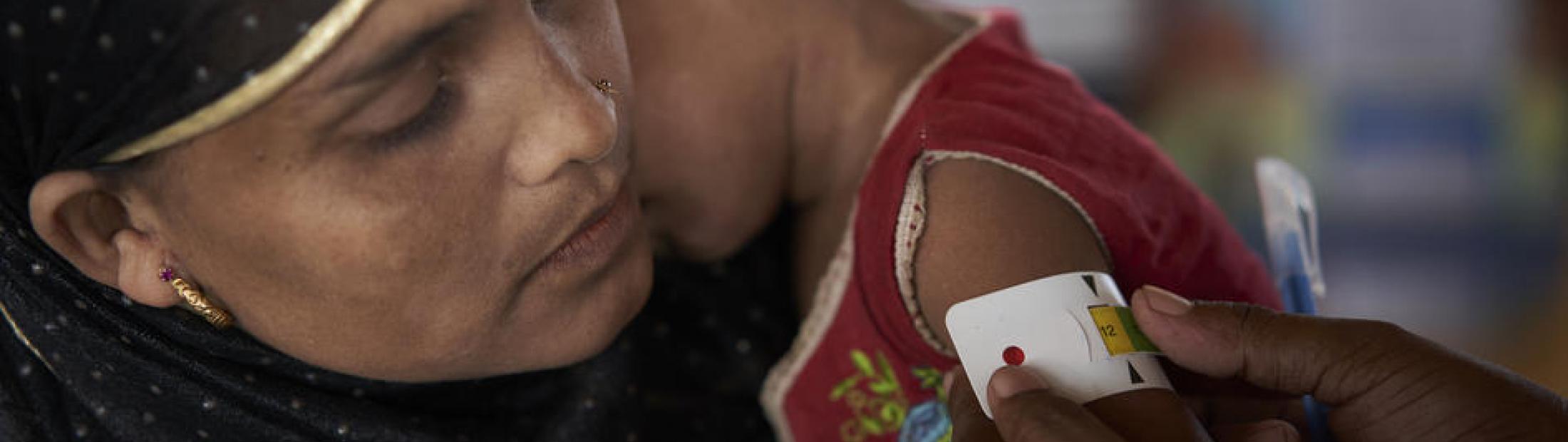 Malnutrición infantil en el mundo: causas y soluciones