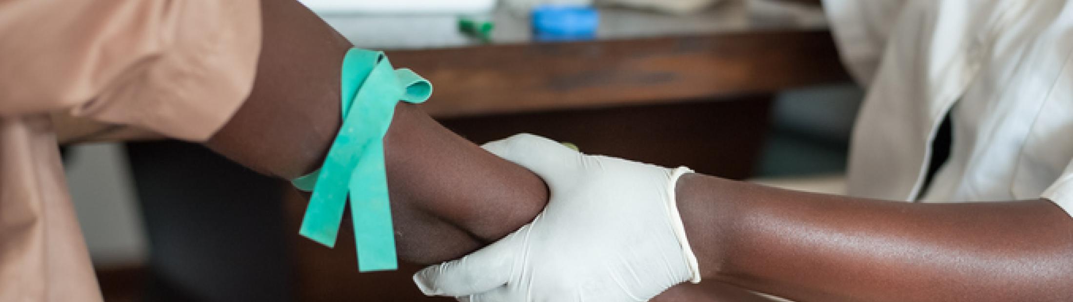 Tratamiento del ébola en África: beneficios e impacto social