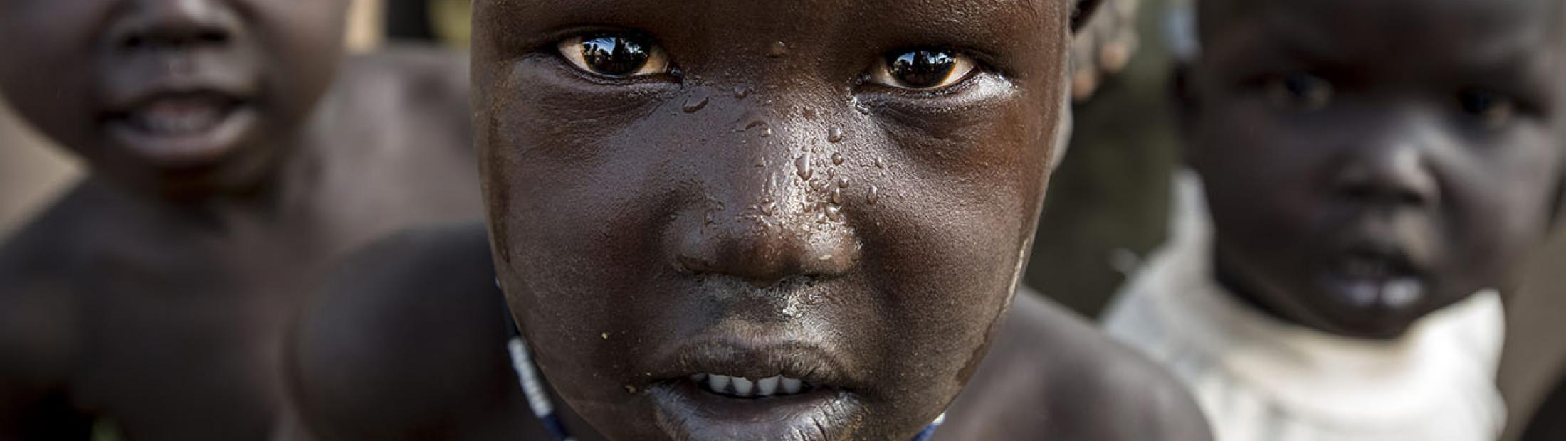 Sudán del Sur: violencia y hambre
