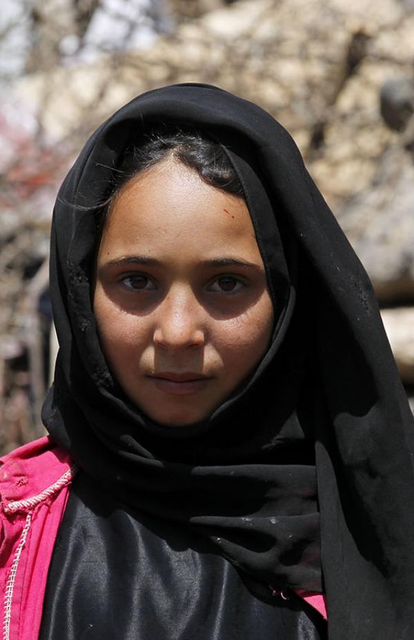6 años de guerra en Yemen: devastación y pobreza 