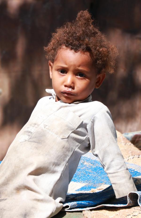 Yemen sufre la peor hambruna de las últimas décadas