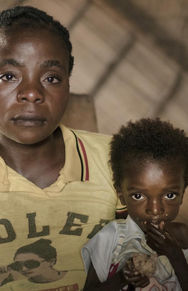 Niños desnutridos, el drama agravado de las crisis humanitarias