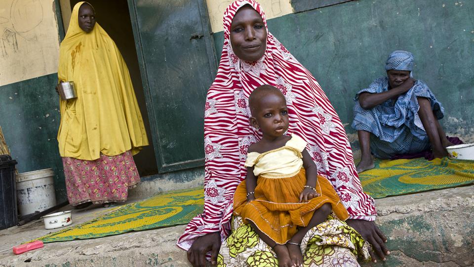 La malnutrición infantil afecta a cientos de niños en Nigeria